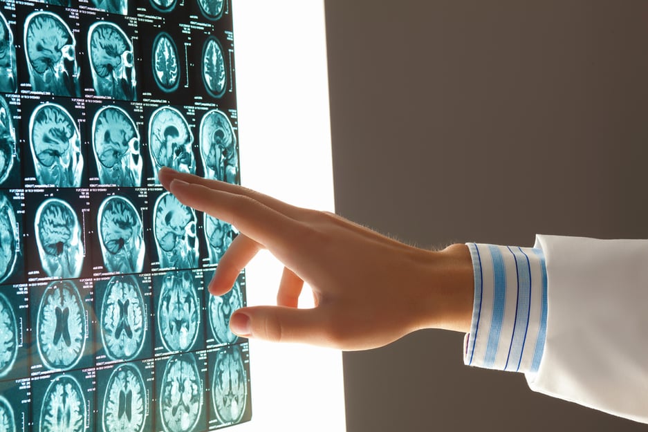NP reviews CT Scan